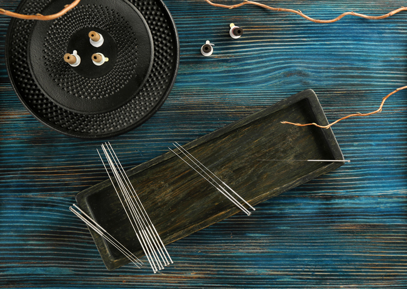 Acupunctuur naalden energie lichaam en geest