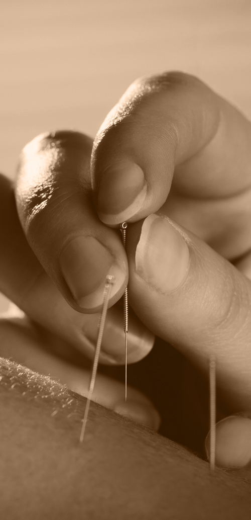 Acupunctuurpraktijk nieuwlands natuurlijke balans met naalden